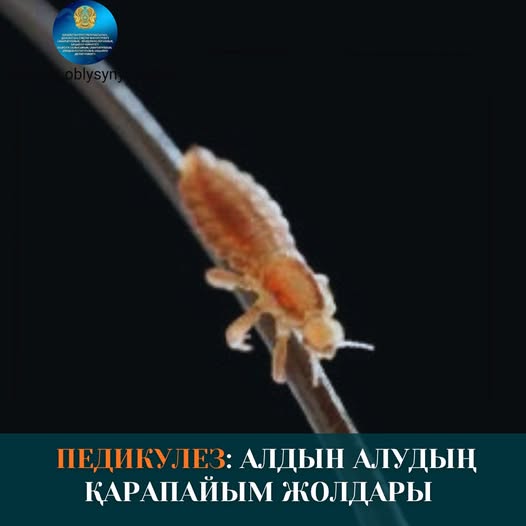 ПЕДИКУЛЕЗ: АЛДЫН АЛУДЫҢ ҚАРАПАЙЫМ ЖОЛДАРЫ