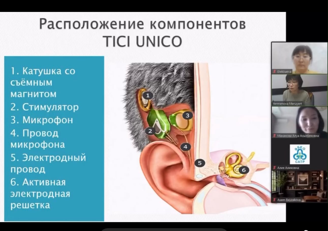 TICI UNICO құрылғысы компоненттерінің орналасу схемасы және сипаттамасы.