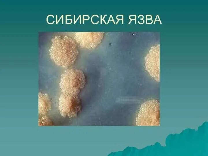 Күйдіргі